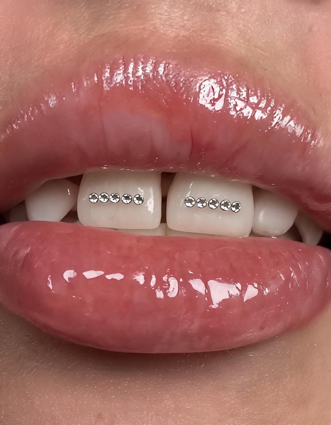 Same smile, tooth gem applied